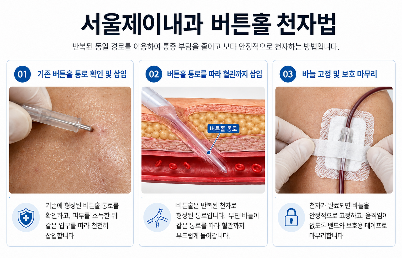 이미지명